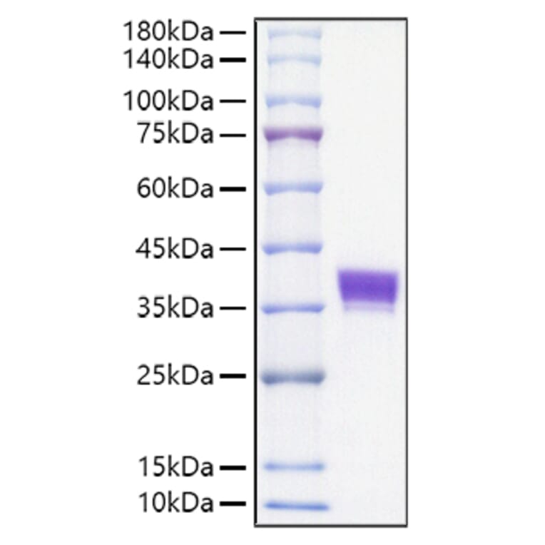 SDS-PAGE - Recombinant Mouse EpCAM Protein (C-terminal His Tag) (A331563) - Antibodies.com