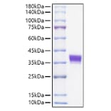 SDS-PAGE - Recombinant Mouse EpCAM Protein (C-terminal His Tag) (A331563) - Antibodies.com