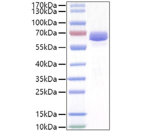 SDS-PAGE - Recombinant Mouse EPHA2 Protein (C-terminal His Tag) (A331564) - Antibodies.com