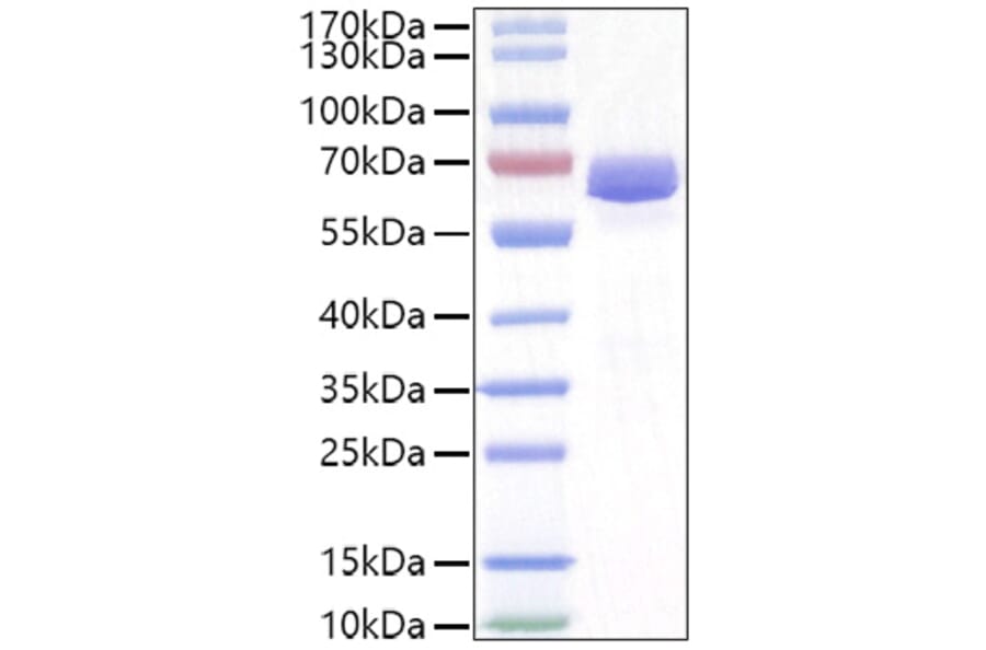 SDS-PAGE - Recombinant Mouse EPHA2 Protein (C-terminal His Tag) (A331564) - Antibodies.com