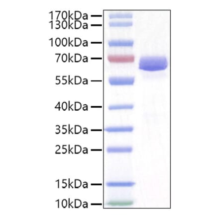 SDS-PAGE - Recombinant Mouse EPHA2 Protein (C-terminal His Tag) (A331564) - Antibodies.com