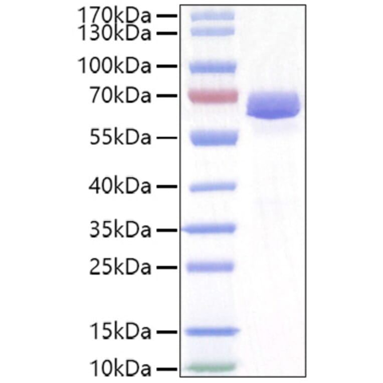SDS-PAGE - Recombinant Mouse EPHA2 Protein (C-terminal His Tag) (A331564) - Antibodies.com