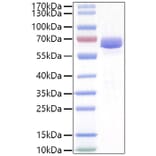 SDS-PAGE - Recombinant Mouse EPHA2 Protein (C-terminal His Tag) (A331564) - Antibodies.com
