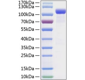 SDS-PAGE - Recombinant Mouse Eph Receptor B2 Protein (C-terminal Human Fc and His Tag) (A331565) - Antibodies.com