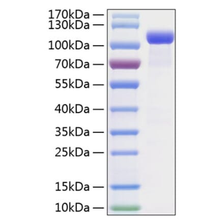 SDS-PAGE - Recombinant Mouse Eph Receptor B2 Protein (C-terminal Human Fc and His Tag) (A331565) - Antibodies.com