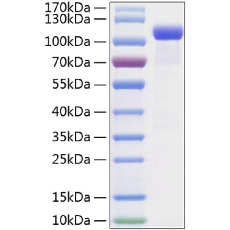 SDS-PAGE - Recombinant Mouse Eph Receptor B2 Protein (C-terminal Human Fc and His Tag) (A331565) - Antibodies.com