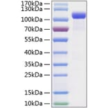 SDS-PAGE - Recombinant Mouse Eph Receptor B2 Protein (C-terminal Human Fc and His Tag) (A331565) - Antibodies.com