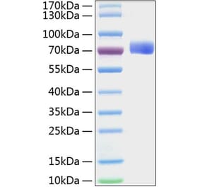 SDS-PAGE - Recombinant Mouse Eph Receptor B2 Protein (C-terminal His Tag) (A331566) - Antibodies.com