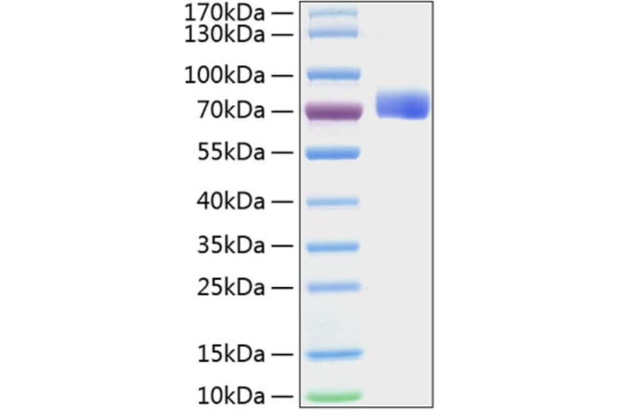 SDS-PAGE - Recombinant Mouse Eph Receptor B2 Protein (C-terminal His Tag) (A331566) - Antibodies.com