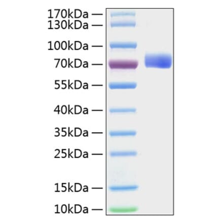SDS-PAGE - Recombinant Mouse Eph Receptor B2 Protein (C-terminal His Tag) (A331566) - Antibodies.com