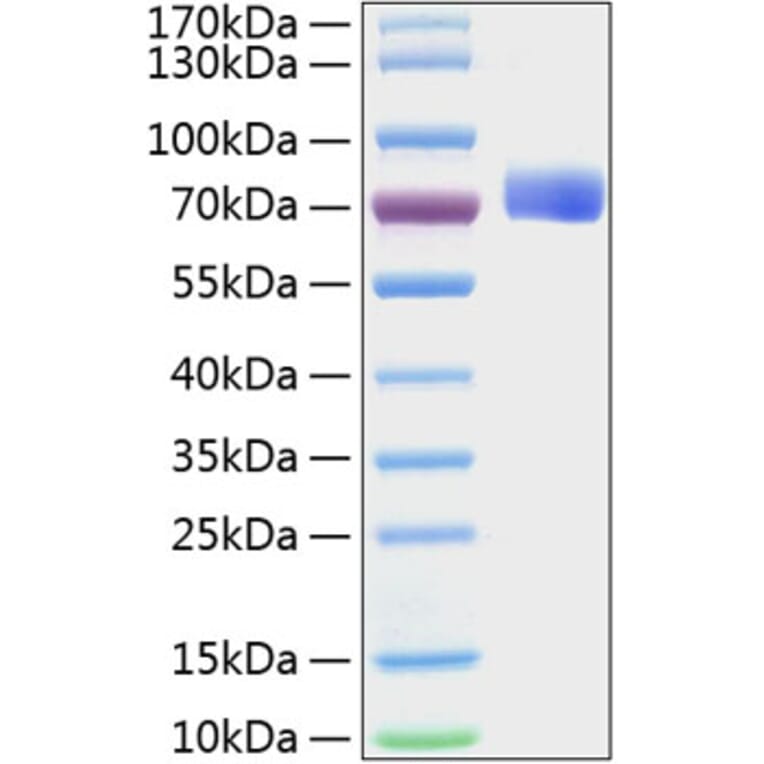 SDS-PAGE - Recombinant Mouse Eph Receptor B2 Protein (C-terminal His Tag) (A331566) - Antibodies.com