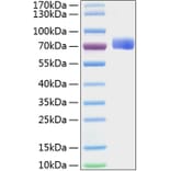 SDS-PAGE - Recombinant Mouse Eph Receptor B2 Protein (C-terminal His Tag) (A331566) - Antibodies.com