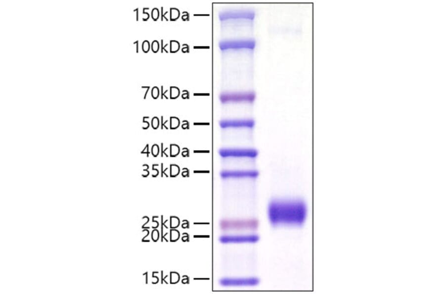 SDS-PAGE - Recombinant Mouse Ephrin A2 Protein (C-terminal His Tag) (A331567) - Antibodies.com