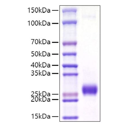 SDS-PAGE - Recombinant Mouse Ephrin A2 Protein (C-terminal His Tag) (A331567) - Antibodies.com