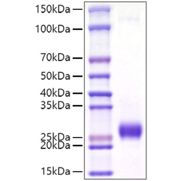 SDS-PAGE - Recombinant Mouse Ephrin A2 Protein (C-terminal His Tag) (A331567) - Antibodies.com