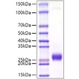 SDS-PAGE - Recombinant Mouse Ephrin A2 Protein (C-terminal His Tag) (A331567) - Antibodies.com