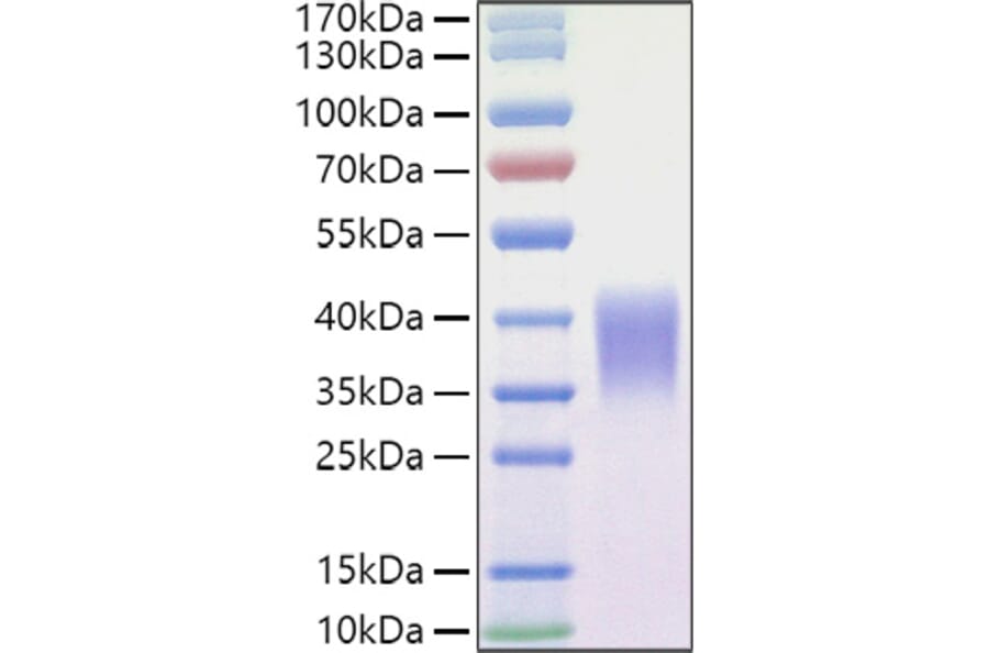 SDS-PAGE - Recombinant Mouse Ephrin B2 Protein (C-terminal His Tag) (A331568) - Antibodies.com