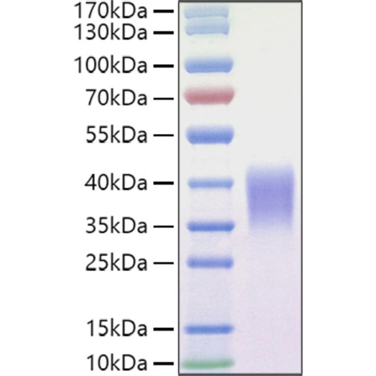 SDS-PAGE - Recombinant Mouse Ephrin B2 Protein (C-terminal His Tag) (A331568) - Antibodies.com