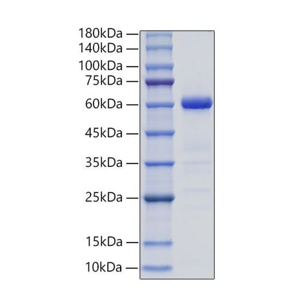 SDS-PAGE - Recombinant Mouse Ephrin B3 Protein (C-terminal Human Fc Tag) (A331569) - Antibodies.com