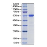 SDS-PAGE - Recombinant Mouse Ephrin B3 Protein (C-terminal Human Fc Tag) (A331569) - Antibodies.com