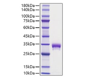 SDS-PAGE - Recombinant Mouse EPOR Protein (C-terminal His Tag) (A331570) - Antibodies.com