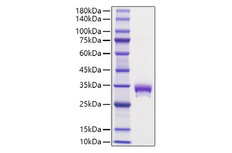 SDS-PAGE - Recombinant Mouse EPOR Protein (C-terminal His Tag) (A331570) - Antibodies.com