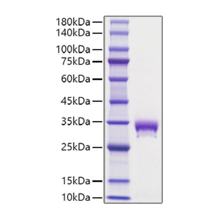 SDS-PAGE - Recombinant Mouse EPOR Protein (C-terminal His Tag) (A331570) - Antibodies.com