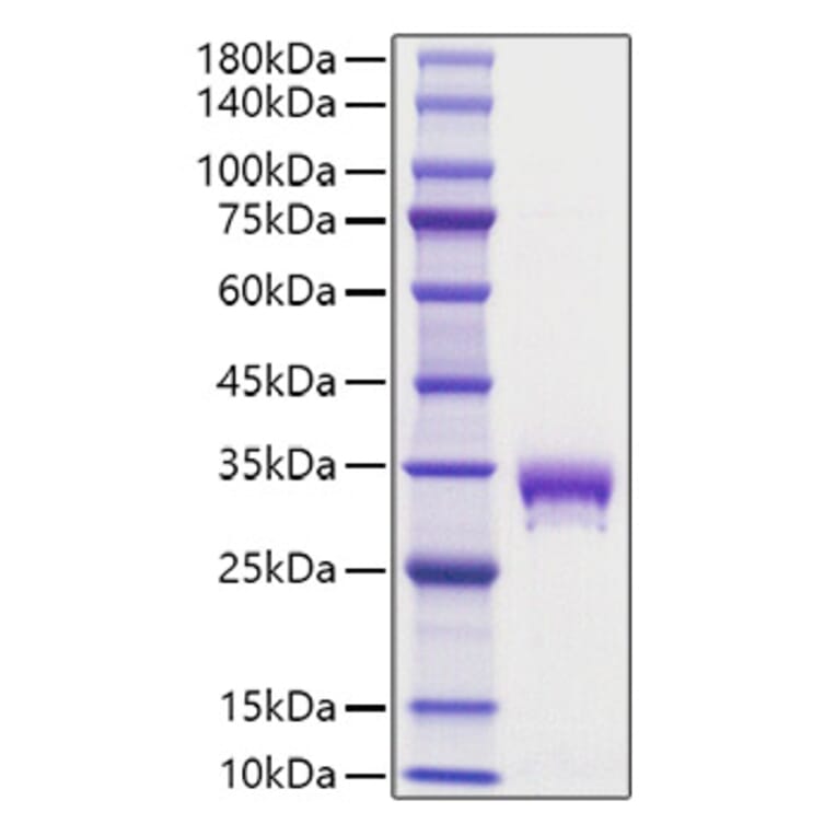 SDS-PAGE - Recombinant Mouse EPOR Protein (C-terminal His Tag) (A331570) - Antibodies.com