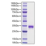 SDS-PAGE - Recombinant Mouse EPOR Protein (C-terminal His Tag) (A331570) - Antibodies.com