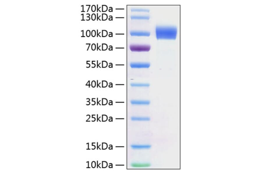 SDS-PAGE - Recombinant Mouse ErbB2 Protein (C-terminal His Tag) (A331571) - Antibodies.com