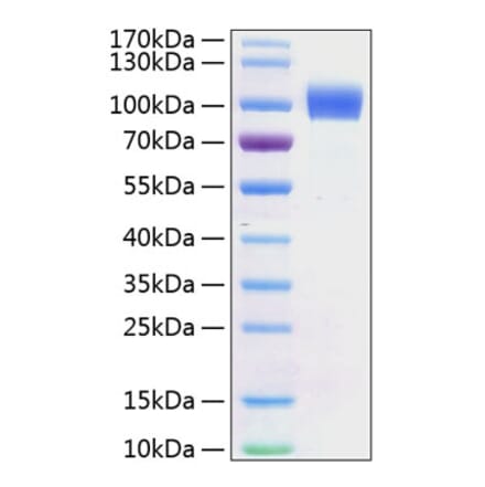 SDS-PAGE - Recombinant Mouse ErbB2 Protein (C-terminal His Tag) (A331571) - Antibodies.com