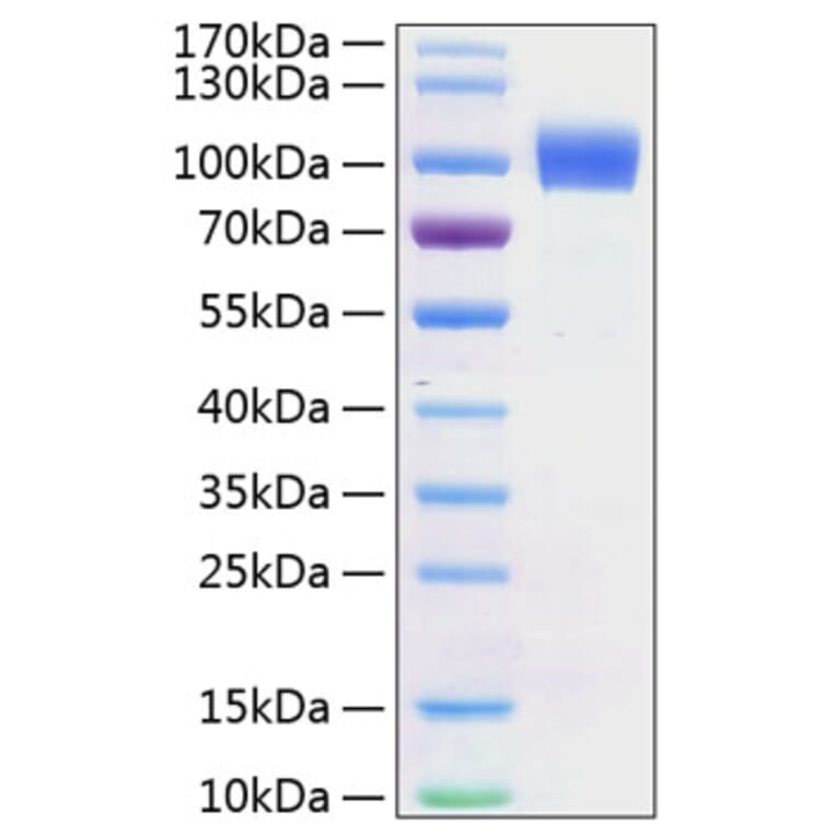 SDS-PAGE - Recombinant Mouse ErbB2 Protein (C-terminal His Tag) (A331571) - Antibodies.com