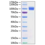 SDS-PAGE - Recombinant Mouse ErbB2 Protein (C-terminal His Tag) (A331571) - Antibodies.com