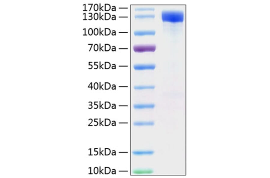 SDS-PAGE - Recombinant Mouse ErbB2 Protein (C-terminal Human Fc and His Tag) (A331572) - Antibodies.com