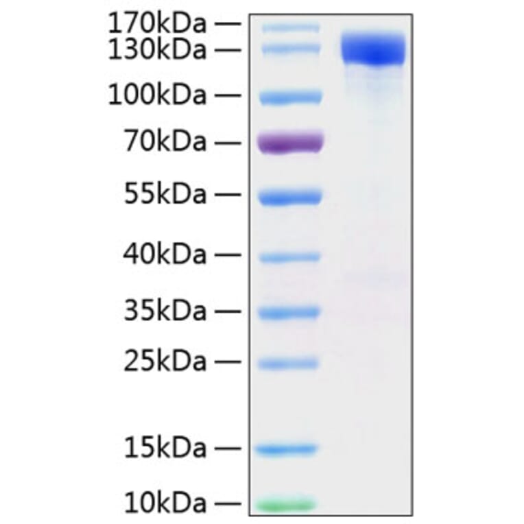 SDS-PAGE - Recombinant Mouse ErbB2 Protein (C-terminal Human Fc and His Tag) (A331572) - Antibodies.com
