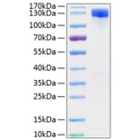SDS-PAGE - Recombinant Mouse ErbB2 Protein (C-terminal Human Fc and His Tag) (A331572) - Antibodies.com