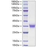 SDS-PAGE - Recombinant Rat EPO Protein (C-terminal His Tag) (A331574) - Antibodies.com