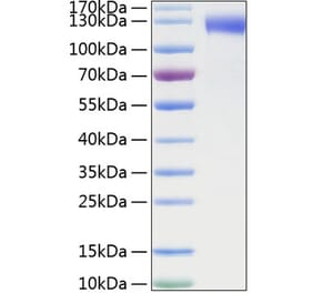 SDS-PAGE - Recombinant Mouse CD62E Protein (C-terminal Human Fc and His Tag) (A331575) - Antibodies.com
