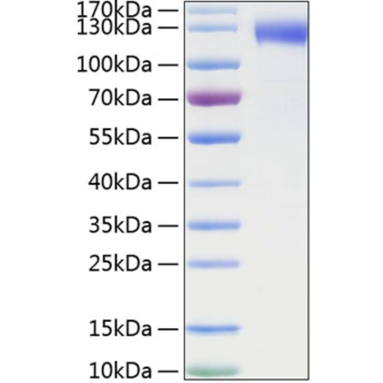 SDS-PAGE - Recombinant Mouse CD62E Protein (C-terminal Human Fc and His Tag) (A331575) - Antibodies.com