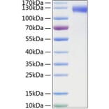 SDS-PAGE - Recombinant Mouse CD62E Protein (C-terminal Human Fc and His Tag) (A331575) - Antibodies.com