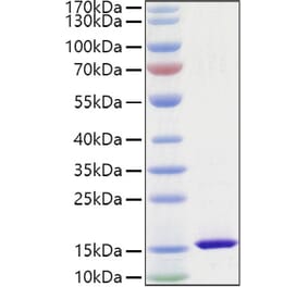 SDS-PAGE - Recombinant Mouse FABP4 Protein (C-terminal His Tag) (A331576) - Antibodies.com