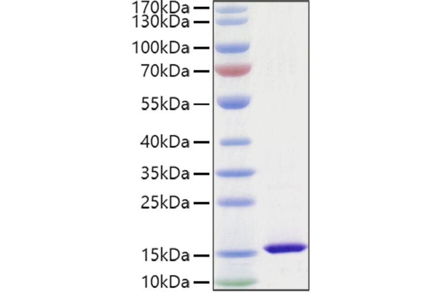 SDS-PAGE - Recombinant Mouse FABP4 Protein (C-terminal His Tag) (A331576) - Antibodies.com
