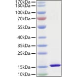 SDS-PAGE - Recombinant Mouse FABP4 Protein (C-terminal His Tag) (A331576) - Antibodies.com