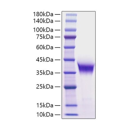 SDS-PAGE - Recombinant Mouse FDPS Protein (N-terminal His Tag) (A331577) - Antibodies.com