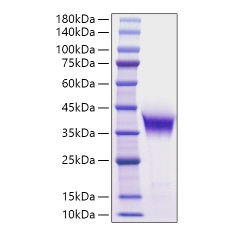 SDS-PAGE - Recombinant Mouse FDPS Protein (N-terminal His Tag) (A331577) - Antibodies.com