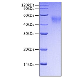 SDS-PAGE - Recombinant Mouse CD64 Protein (C-terminal His Tag) (A331578) - Antibodies.com