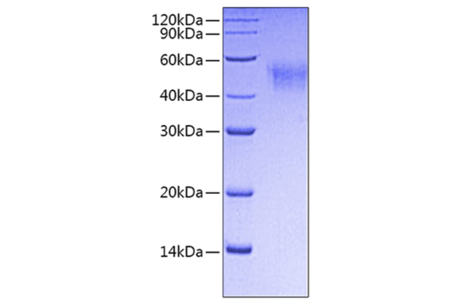 SDS-PAGE - Recombinant Mouse CD64 Protein (C-terminal His Tag) (A331578) - Antibodies.com