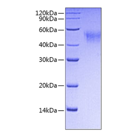 SDS-PAGE - Recombinant Mouse CD64 Protein (C-terminal His Tag) (A331578) - Antibodies.com
