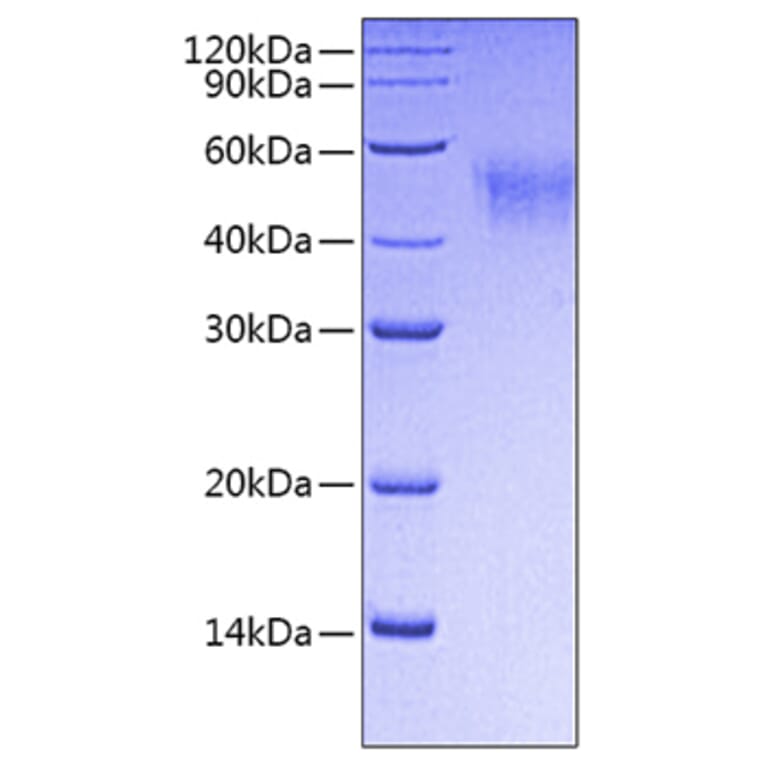 SDS-PAGE - Recombinant Mouse CD64 Protein (C-terminal His Tag) (A331578) - Antibodies.com