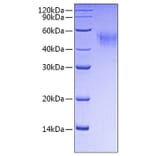 SDS-PAGE - Recombinant Mouse CD64 Protein (C-terminal His Tag) (A331578) - Antibodies.com